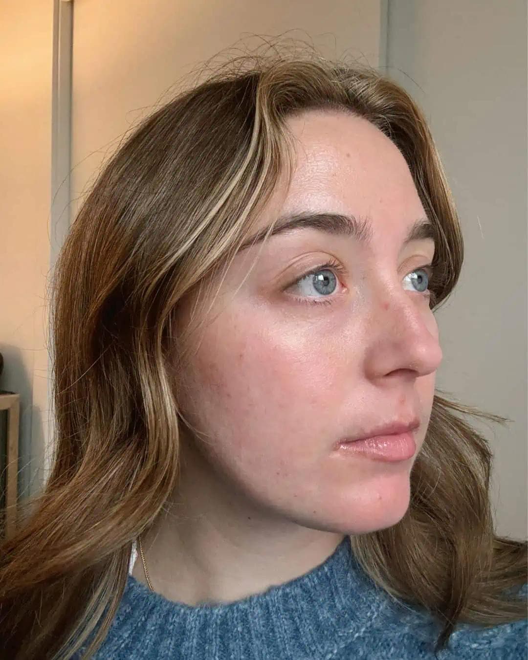 Accutane Skincare Routine & Product Recommendations